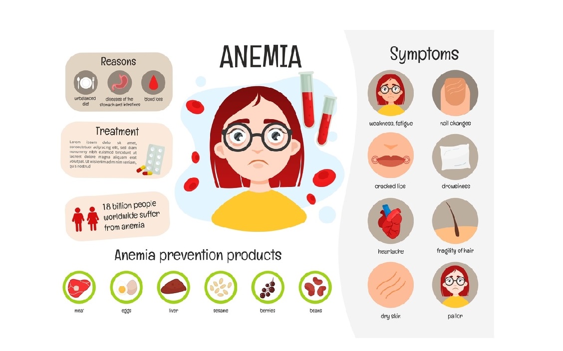 Anemia - Causes, Symptoms and Treatment