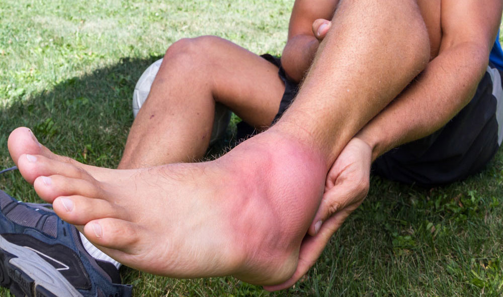 Common Causes of Foot and Ankle Tendonitis