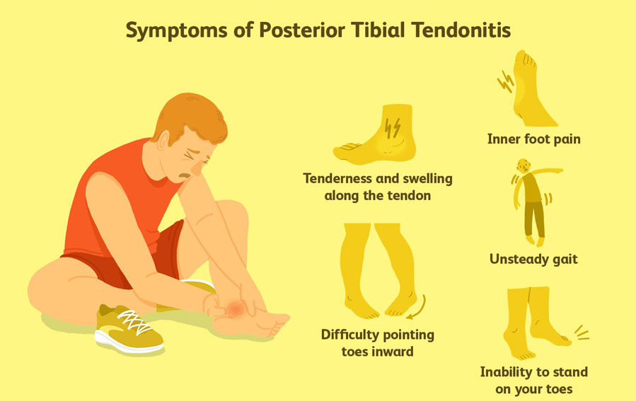 Treatment of Foot and Ankle Tendonitis