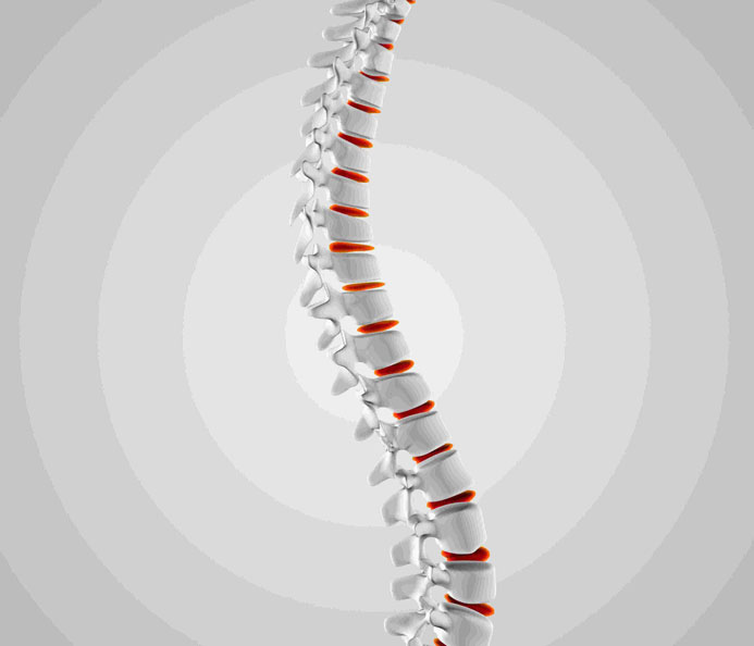spine pain
