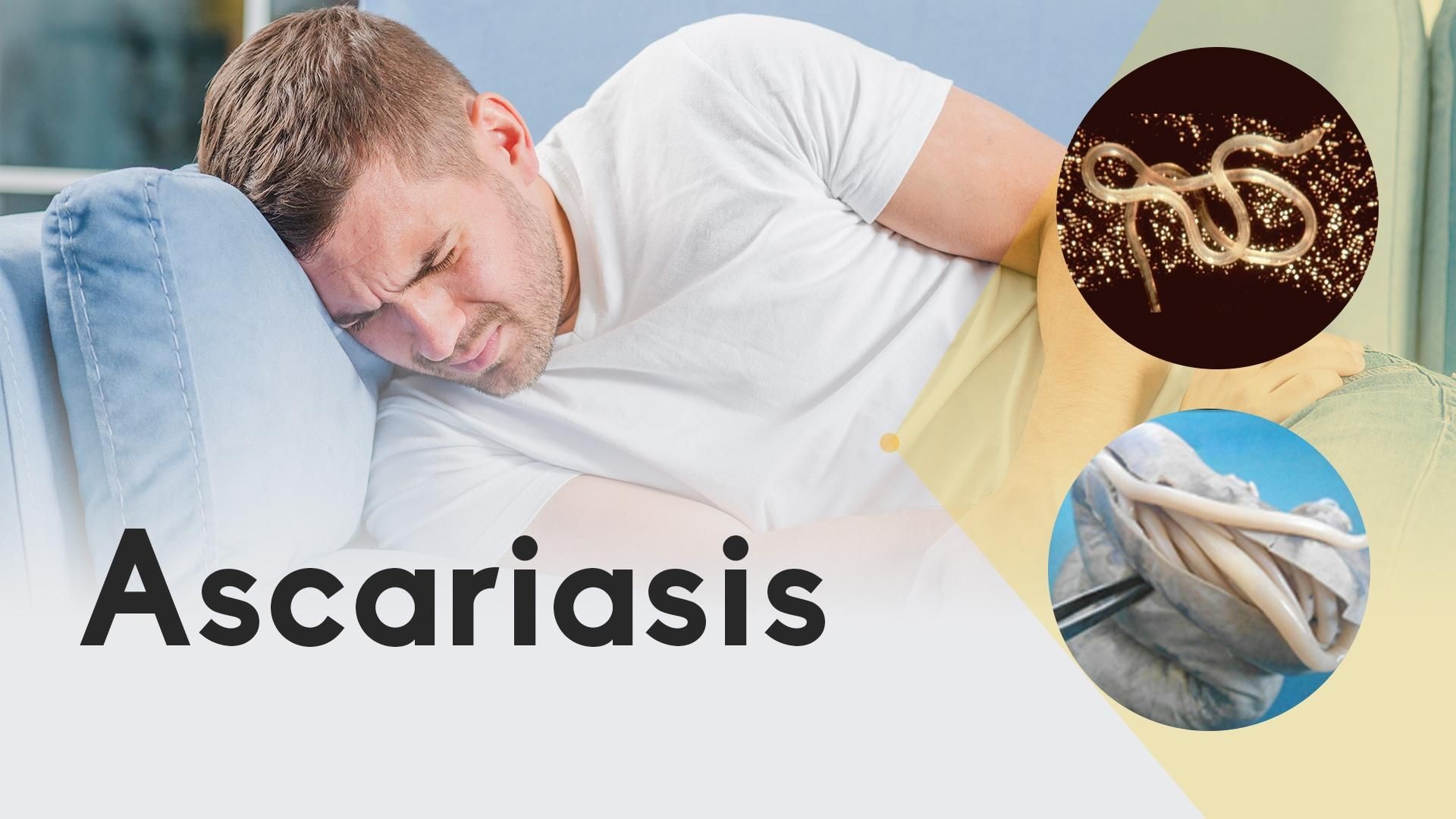 What is Ascariasis? | Specialty Care Clinics